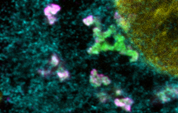 Hardened influenza A viral inclusions that lost their dynamic behaviour. The endoplasmic reticulum in cyan, viruses labeled in magente and Rab11a labelled in green.
