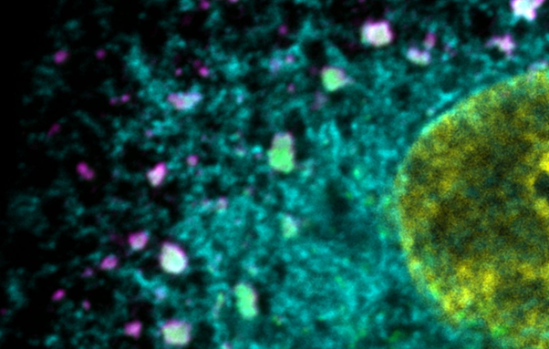 Normal influenza A viral inclusions in infected cell that drive ithe assembly of segmented genome. The endoplasmic reticulum in cyan, viruses labeled in magente and Rab11a labelled in green.
