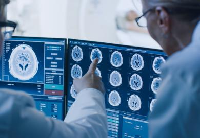 Two people examine brain scans on a computer
