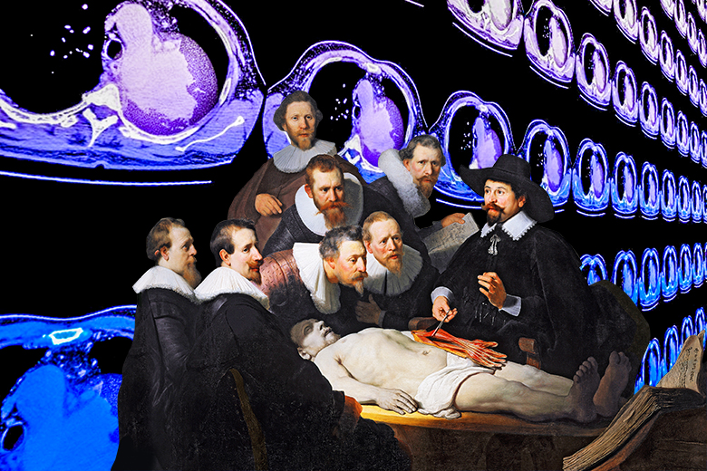 The Anatomy Lesson of Dr Nicolaes Tulp, 1632, by Rembrandt, with an added background showing coloured computed tomography (CT) scans of lung cancer. To illustrate that AI algorithms can diagnose more accurately than specialist clinicians. The Anatomy Lesson of Dr Nicolaes Tulp, 1632, by Rembrandt, with an added background showing coloured computed tomography (CT) scans of lung cancer. To illustrate that AI algorithms can diagnose more accurately than specialist clinicians.
