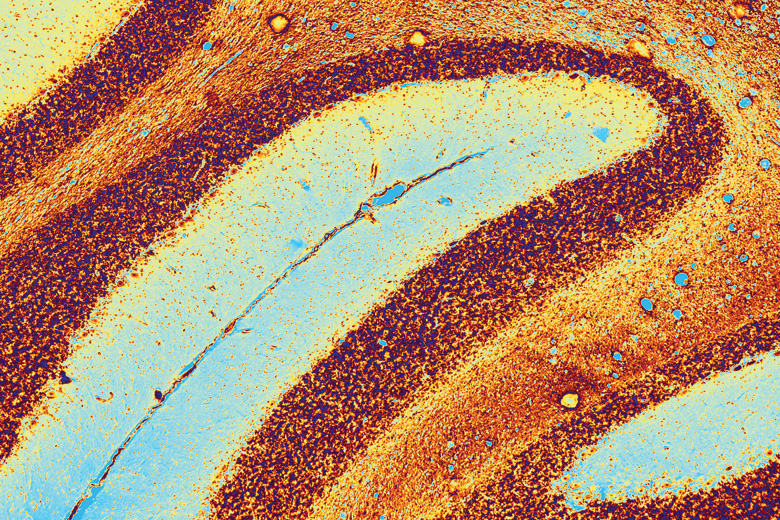 Coloured light micrograph of section through cerebellum of brain