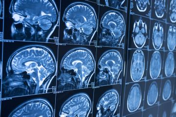 Brain scan Brain scan