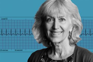 Joan Taylor with a background showing an electrocardiogram of atrial tachycardia. Joan Taylor with a background showing an electrocardiogram of atrial tachycardia.