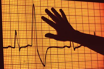 An image from an electrocardiogram