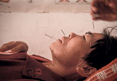 Acupuncture