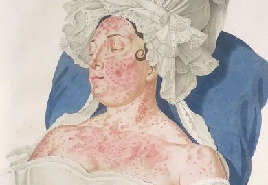 skin disease woman