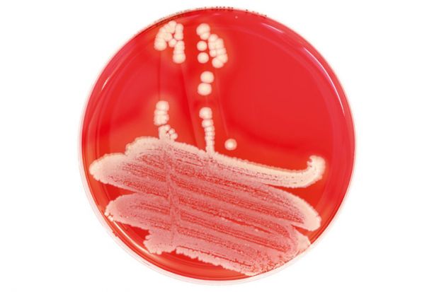 Close-up of petri dish