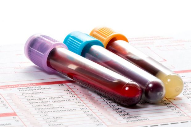 medical-trial-blood-vials