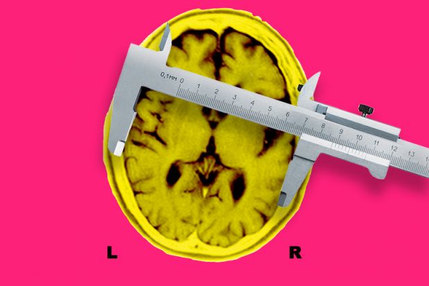 MRI of the brain of a patient affected by Alzheimer’s disease axial section, with calipers measuring. To illustrate how Aria can prove its worth in brain disorders and other projects.